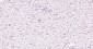PCNA Mouse mAb